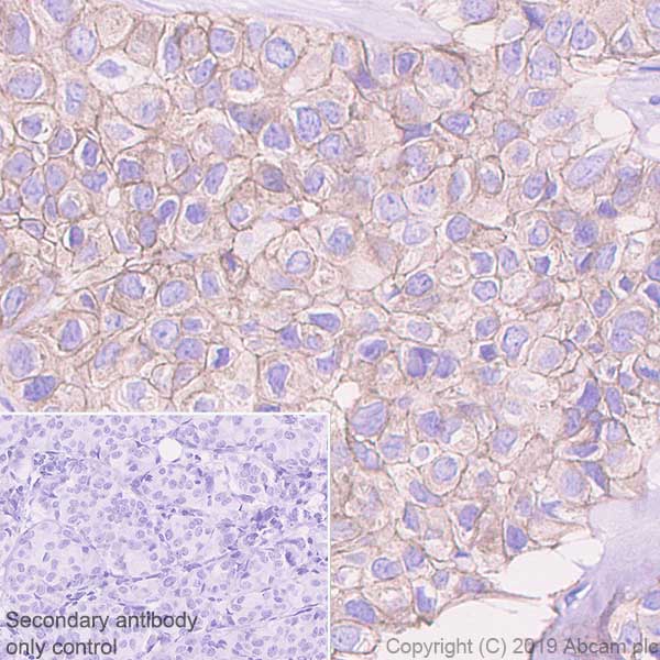 Immunohistochemistry (Formalin/PFA-fixed paraffin-embedded sections) - Anti-ErbB3 / HER3 antibody [EPR22669-25] - BSA and Azide free (AB256504)