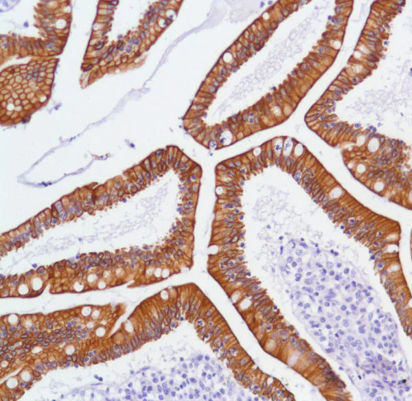 Immunohistochemistry (Formalin/PFA-fixed paraffin-embedded sections) - Anti-ErbB3 / HER3 antibody [SP71] (AB93739)