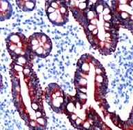 Immunohistochemistry (Formalin/PFA-fixed paraffin-embedded sections) - Anti-ErbB3 / HER3 antibody [SP71] (AB93739)