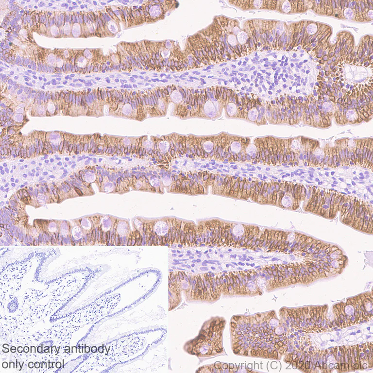 Immunohistochemistry (Formalin/PFA-fixed paraffin-embedded sections) - Anti-ErbB3 / HER3 antibody [SP71] (AB93739)