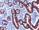 Immunohistochemistry (Formalin/PFA-fixed paraffin-embedded sections) - Anti-ErbB3 / HER3 antibody [SP71], prediluted (AB101544), expandable thumbnail