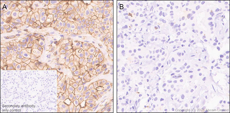 Immunohistochemistry (Formalin/PFA-fixed paraffin-embedded sections) - Anti-ErbB3 / HER3 (phospho Y1289) antibody [EPR28708-19] (AB323861)