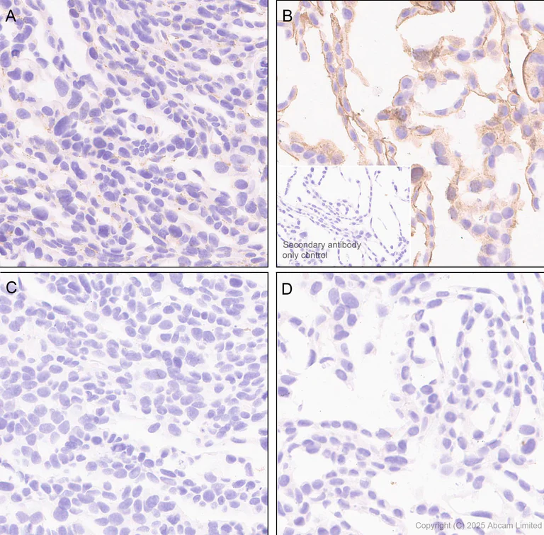 Immunohistochemistry (Formalin/PFA-fixed paraffin-embedded sections) - Anti-ErbB3 / HER3 (phospho Y1289) antibody [EPR28708-19] (AB323861)