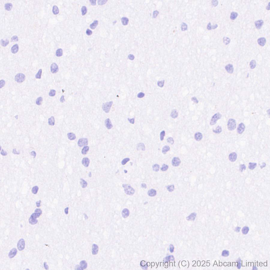 Immunohistochemistry (Formalin/PFA-fixed paraffin-embedded sections) - Anti-ErbB3 / HER3 (phospho Y1289) antibody [EPR28708-19] (AB323861), expandable thumbnail
