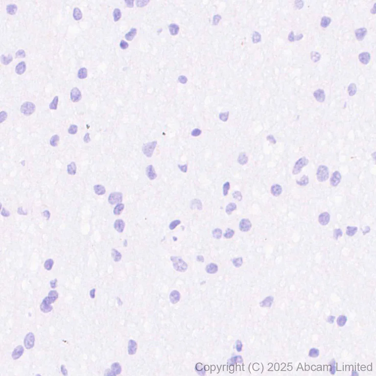 Immunohistochemistry (Formalin/PFA-fixed paraffin-embedded sections) - Anti-ErbB3 / HER3 (phospho Y1289) antibody [EPR28708-19] (AB323861)