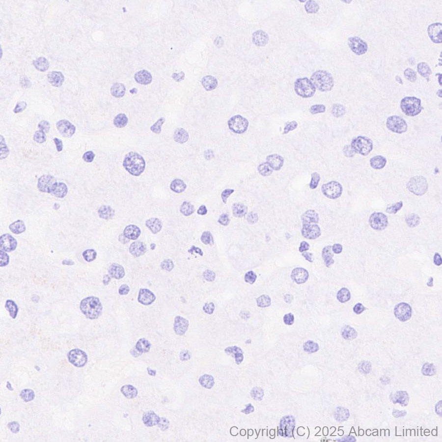 Immunohistochemistry (Formalin/PFA-fixed paraffin-embedded sections) - Anti-ErbB3 / HER3 (phospho Y1289) antibody [EPR28708-19] (AB323861), expandable thumbnail