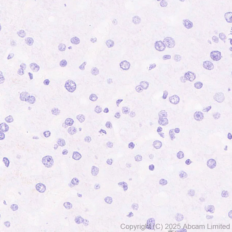 Immunohistochemistry (Formalin/PFA-fixed paraffin-embedded sections) - Anti-ErbB3 / HER3 (phospho Y1289) antibody [EPR28708-19] (AB323861)