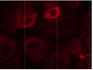 Immunocytochemistry/ Immunofluorescence - Anti-ErbB3 / HER3 (phospho Y1328) antibody (AB131444)