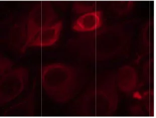 Immunocytochemistry/ Immunofluorescence - Anti-ErbB3 / HER3 (phospho Y1328) antibody (AB131444)