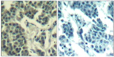 Immunohistochemistry (Formalin/PFA-fixed paraffin-embedded sections) - Anti-ErbB3 / HER3 (phospho Y1328) antibody (AB131444)