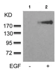 Western blot - Anti-ErbB3 / HER3 (phospho Y1328) antibody (AB131444)