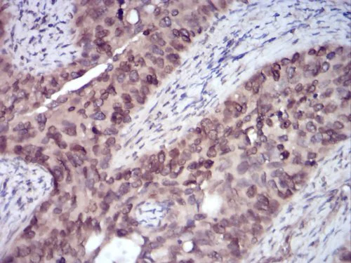 Immunohistochemistry (Formalin/PFA-fixed paraffin-embedded sections) - Anti-ErbB4 / HER4 antibody [5G6B4] - C-terminal (AB204959)