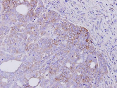 Immunohistochemistry (Formalin/PFA-fixed paraffin-embedded sections) - Anti-ErbB4 / HER4 antibody (AB137412), expandable thumbnail