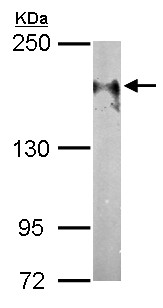 Western blot - Anti-ErbB4 / HER4 antibody (AB137412), expandable thumbnail