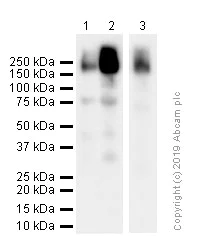 Western blot - Anti-ErbB4 / HER4 antibody [E200] (AB32375)