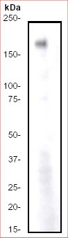 Western blot - Anti-ErbB4 / HER4 antibody [E200] (AB32375)