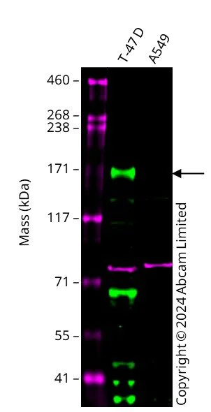 Western blot - Anti-ErbB4 / HER4 antibody [E200] - BSA and Azide free (AB183299)