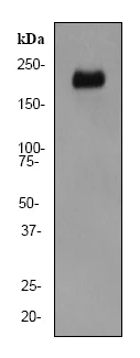 Western blot - Anti-ErbB4 / HER4 antibody [EP192Y] (AB76303)