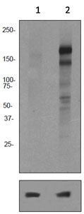 Western blot - Anti-ErbB4 / HER4 (phospho Y1056) antibody [EPR2269] (AB92782), expandable thumbnail
