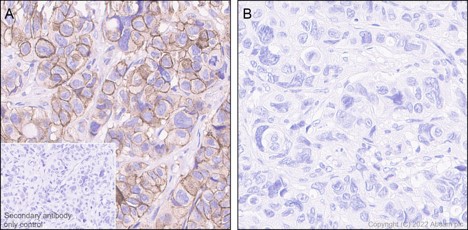 Immunohistochemistry (Formalin/PFA-fixed paraffin-embedded sections) - Anti-ErbB4 / HER4 (phospho Y1162) antibody [EP2270Y] (AB68478)
