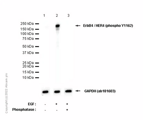 Western blot - Anti-ErbB4 / HER4 (phospho Y1162) antibody [EP2270Y] - BSA and Azide free (AB247386)