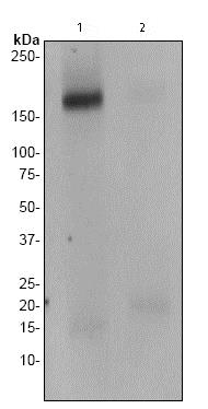 Western blot - Anti-ErbB4 / HER4 (phospho Y1258) antibody [EP2272AY] (AB76132)