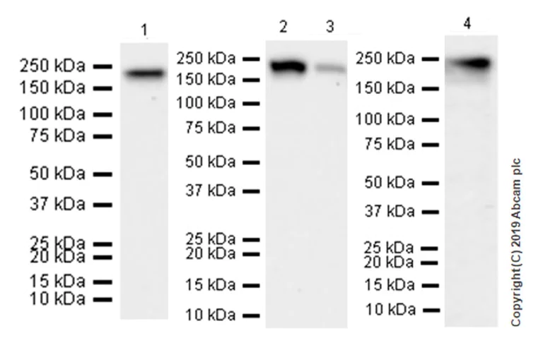 Western blot - Anti-ErbB4 / HER4+ErbB2 / HER2 antibody [EPR22665-104] (AB219208)