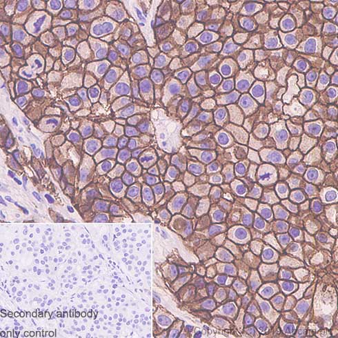 Immunohistochemistry (Formalin/PFA-fixed paraffin-embedded sections) - Anti-ErbB4 / HER4+ErbB2 / HER2 antibody [EPR22665-104] - BSA and Azide free (AB263027), expandable thumbnail