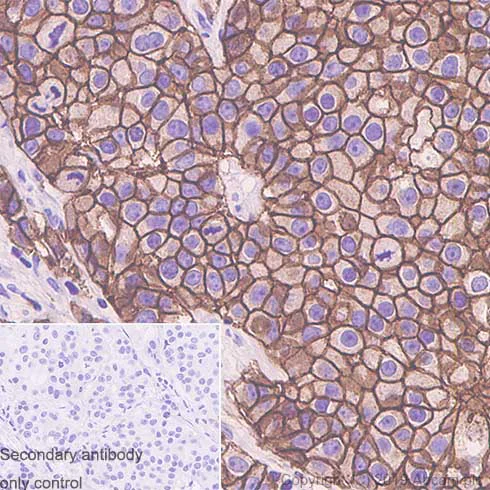 Immunohistochemistry (Formalin/PFA-fixed paraffin-embedded sections) - Anti-ErbB4 / HER4+ErbB2 / HER2 antibody [EPR22665-104] - BSA and Azide free (AB263027)