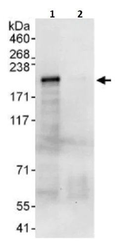 Immunoprecipitation - Anti-Erbin antibody (AB241948)