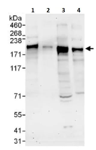 Western blot - Anti-Erbin antibody (AB241948)