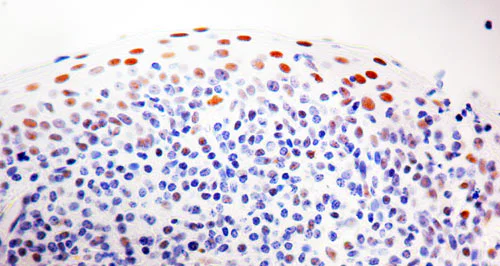 Immunohistochemistry (Formalin/PFA-fixed paraffin-embedded sections) - Anti-ERCC1 antibody [8F1] (AB2356)