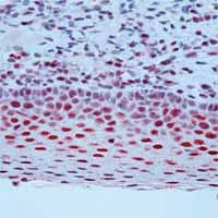 Immunohistochemistry (Formalin/PFA-fixed paraffin-embedded sections) - Anti-ERCC1 antibody [8F1] (AB2356)