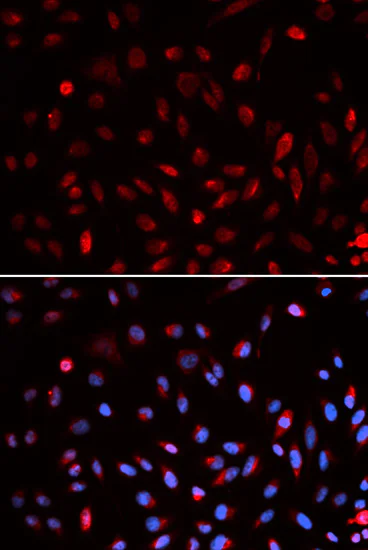 Immunocytochemistry/ Immunofluorescence - Anti-ERCC1 antibody (AB196869)
