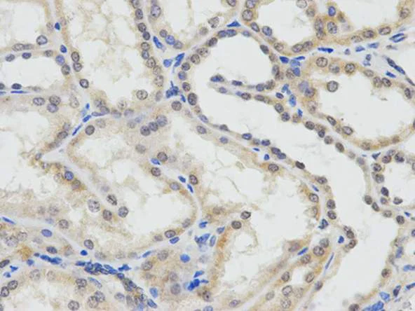 Immunohistochemistry (Formalin/PFA-fixed paraffin-embedded sections) - Anti-ERCC1 antibody (AB196869)