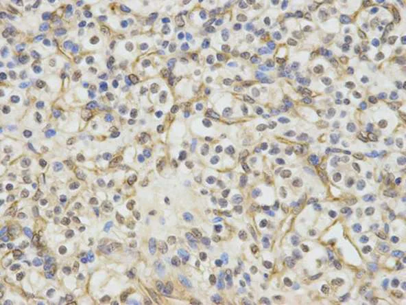 Immunohistochemistry (Formalin/PFA-fixed paraffin-embedded sections) - Anti-ERCC1 antibody (AB196869)