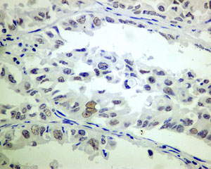 Immunohistochemistry (Formalin/PFA-fixed paraffin-embedded sections) - Anti-ERCC1 antibody [EPR7062] (AB129093)