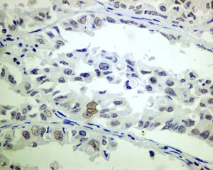 Immunocytochemistry/ Immunofluorescence - Anti-ERCC1 antibody [EPR7062] - BSA and Azide free (AB232031)