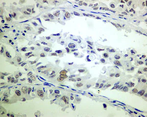 Immunohistochemistry (Formalin/PFA-fixed paraffin-embedded sections) - Anti-ERCC1 antibody [EPR7062] - BSA and Azide free (AB232031)
