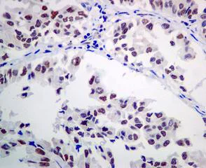 Immunohistochemistry (Formalin/PFA-fixed paraffin-embedded sections) - Anti-ERCC1 antibody [EPR7277] - BSA and Azide free (AB232422)