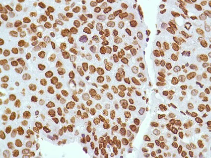 Immunohistochemistry (Formalin/PFA-fixed paraffin-embedded sections) - Anti-ERCC1 antibody [SP68] (AB225721)