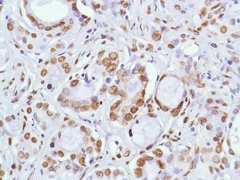 Immunohistochemistry (Formalin/PFA-fixed paraffin-embedded sections) - Anti-ERCC1 antibody [SP68] (AB225721)