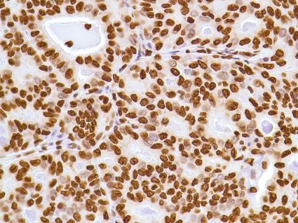 Immunohistochemistry (Formalin/PFA-fixed paraffin-embedded sections) - Anti-ERCC1 antibody [SP68] (AB225721)