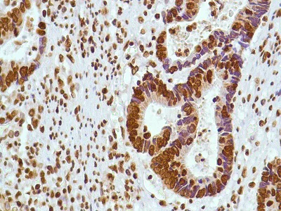 Immunohistochemistry (Formalin/PFA-fixed paraffin-embedded sections) - Anti-ERCC1 antibody [SP68] (AB225721)