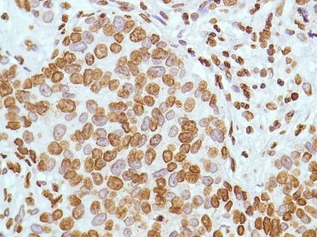 Immunohistochemistry (Formalin/PFA-fixed paraffin-embedded sections) - Anti-ERCC1 antibody [SP68] (AB225721)