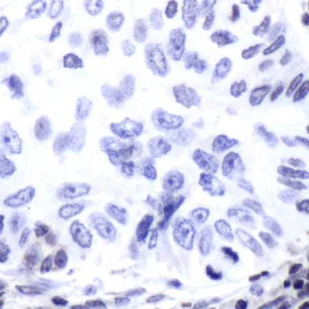 Immunohistochemistry (Formalin/PFA-fixed paraffin-embedded sections) - Anti-ERCC1 antibody [SP68] (AB225721)