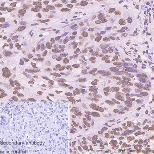 Immunohistochemistry (Formalin/PFA-fixed paraffin-embedded sections) - Anti-ERCC1 antibody [SP68] (AB225721)