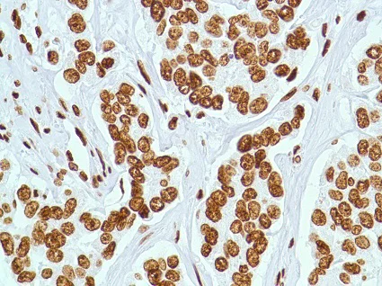 Immunohistochemistry (Formalin/PFA-fixed paraffin-embedded sections) - Anti-ERCC1 antibody [SP68] - BSA and Azide free (AB236442)
