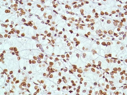 Immunohistochemistry (Formalin/PFA-fixed paraffin-embedded sections) - Anti-ERCC1 antibody [SP68] - BSA and Azide free (AB236442)