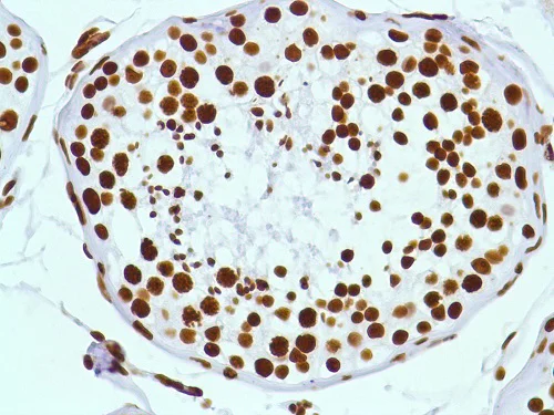 Immunohistochemistry (Formalin/PFA-fixed paraffin-embedded sections) - Anti-ERCC1 antibody [SP68] - BSA and Azide free (AB236442)